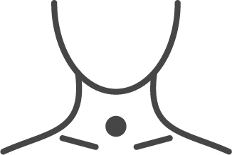 tracheacanule